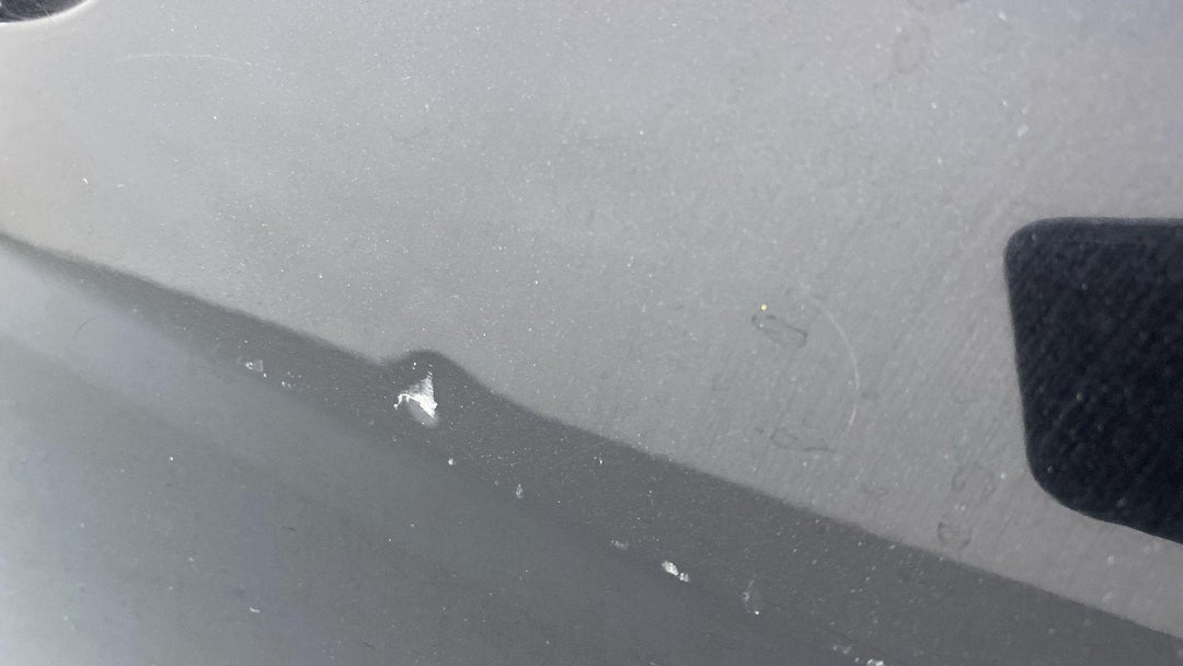 DENT